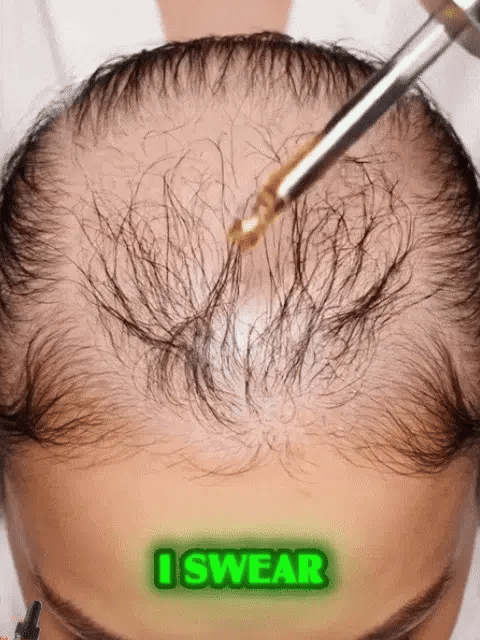 [No.1 Selling Hair Growth Product] Battana Rosemary Essential Oil