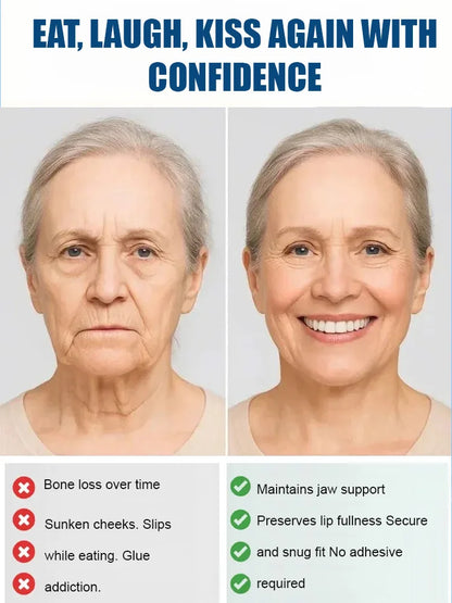 【Made in USA, FDA Approved】Custom Full Mouth Dentures Kit