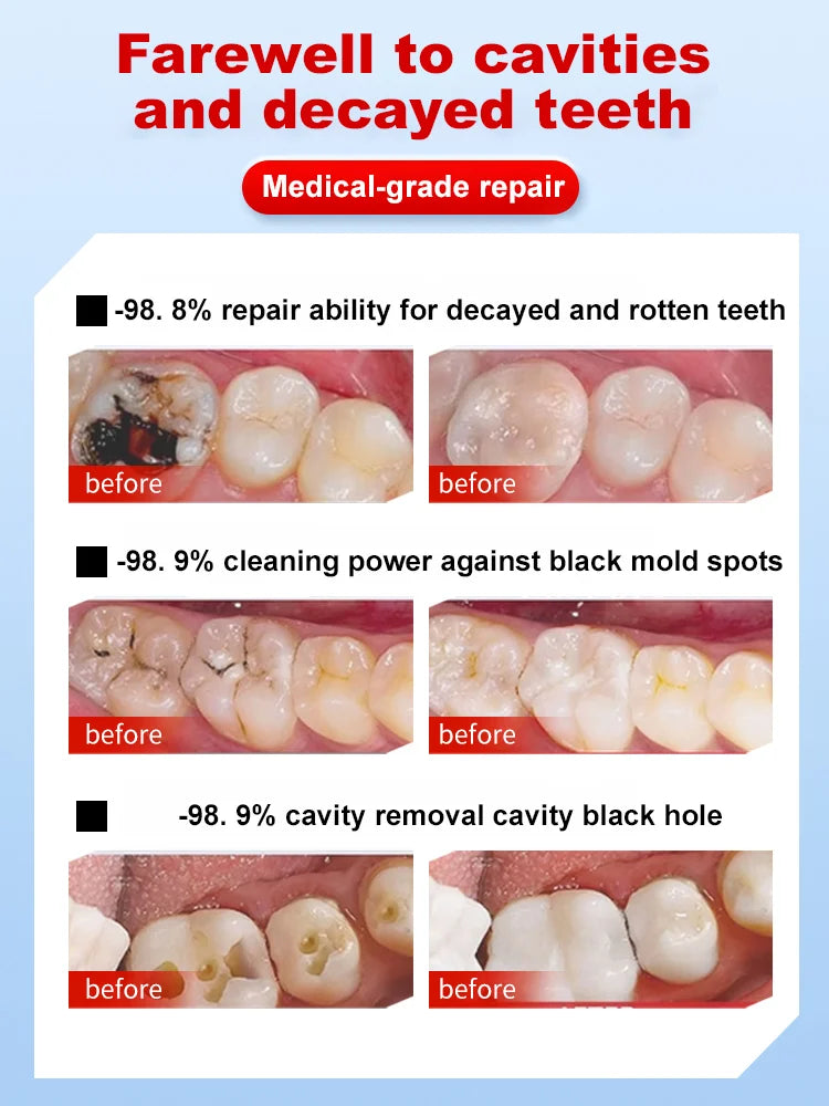 [Instant Repair Toothpaste] 7.5% Nano Hydroxyapatite Toothpaste