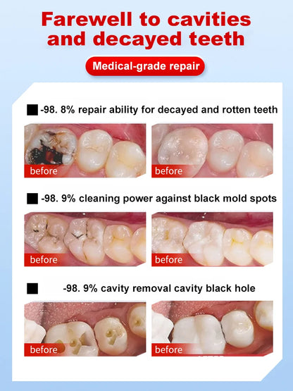 [Instant Repair Toothpaste] 7.5% Nano Hydroxyapatite Toothpaste
