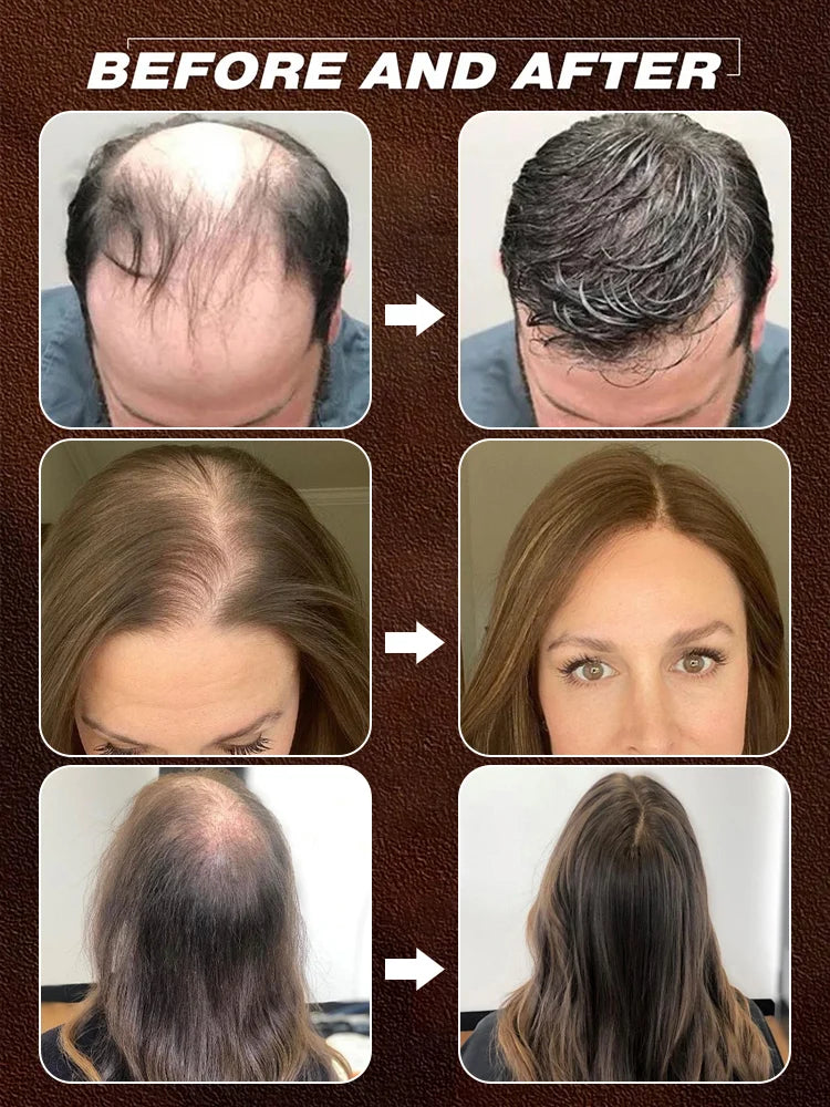 [No.1 Selling Hair Growth Product] Battana Rosemary Essential Oil