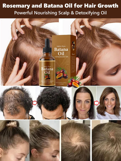 [No.1 Selling Hair Growth Product] Battana Rosemary Essential Oil