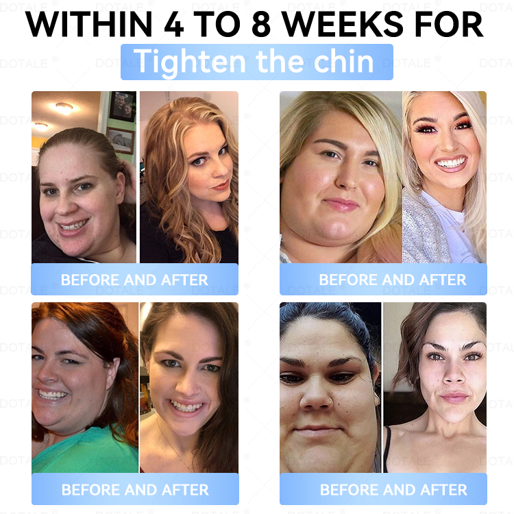 𝑫𝑶𝑻𝑨𝑳𝑬® 𝑴𝒆𝒕𝒂𝒃𝒐𝒍𝒊𝒄 𝑵𝒂𝒏𝒐 𝑴𝒊𝒄𝒓𝒐𝒏𝒆𝒆𝒅𝒍𝒆 𝑷𝒂𝒕𝒄𝒉(𝐉𝐮𝐬𝐭 𝐨𝐧𝐜𝐞 𝐚 𝐝𝐚𝐲, 𝐯𝐢𝐬𝐢𝐛𝐥𝐞 𝐜𝐡𝐚𝐧𝐠𝐞𝐬 𝐢𝐧 𝟕 𝐝𝐚𝐲𝐬）𝘽𝙚𝙧𝙗𝙚𝙧𝙞𝙣𝙚 + 𝙈𝙤𝙧𝙞𝙣𝙜𝙖 𝙁𝙤𝙧𝙢𝙪𝙡𝙖 ✅ 𝐅𝐨𝐫 𝐨𝐛𝐞𝐬𝐢𝐭𝐲, 𝗟𝗼𝗼𝘀𝗲 𝘀𝗸𝗶𝗻,𝐝𝐢𝐚𝐛𝐞𝐭𝐞𝐬, 𝐬𝐥𝐞𝐞𝐩 𝐚𝐩𝐧𝐞𝐚, 𝐣𝐨𝐢𝐧𝐭 𝐢𝐬𝐬𝐮𝐞𝐬, 𝐚𝐧𝐝 𝐦𝐨𝐫𝐞