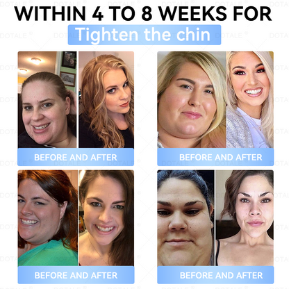 𝑫𝑶𝑻𝑨𝑳𝑬® 𝑴𝒆𝒕𝒂𝒃𝒐𝒍𝒊𝒄 𝑵𝒂𝒏𝒐 𝑴𝒊𝒄𝒓𝒐𝒏𝒆𝒆𝒅𝒍𝒆 𝑷𝒂𝒕𝒄𝒉(𝐉𝐮𝐬𝐭 𝐨𝐧𝐜𝐞 𝐚 𝐝𝐚𝐲, 𝐯𝐢𝐬𝐢𝐛𝐥𝐞 𝐜𝐡𝐚𝐧𝐠𝐞𝐬 𝐢𝐧 𝟕 𝐝𝐚𝐲𝐬）𝘽𝙚𝙧𝙗𝙚𝙧𝙞𝙣𝙚 + 𝙈𝙤𝙧𝙞𝙣𝙜𝙖 𝙁𝙤𝙧𝙢𝙪𝙡𝙖 ✅ 𝐅𝐨𝐫 𝐨𝐛𝐞𝐬𝐢𝐭𝐲, 𝗟𝗼𝗼𝘀𝗲 𝘀𝗸𝗶𝗻,𝐝𝐢𝐚𝐛𝐞𝐭𝐞𝐬, 𝐬𝐥𝐞𝐞𝐩 𝐚𝐩𝐧𝐞𝐚, 𝐣𝐨𝐢𝐧𝐭 𝐢𝐬𝐬𝐮𝐞𝐬, 𝐚𝐧𝐝 𝐦𝐨𝐫𝐞