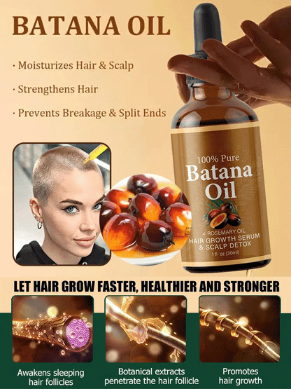 [No.1 Selling Hair Growth Product] Battana Rosemary Essential Oil