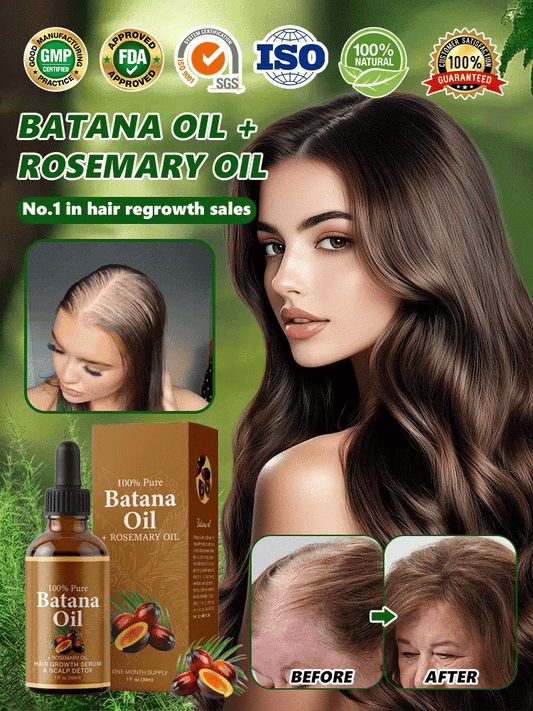 [No.1 Selling Hair Growth Product] Battana Rosemary Essential Oil