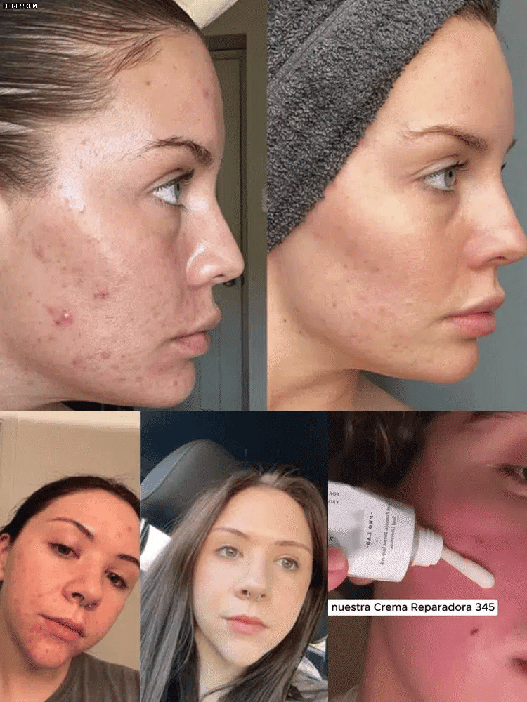 Hydrating and Nourishing Face Cream