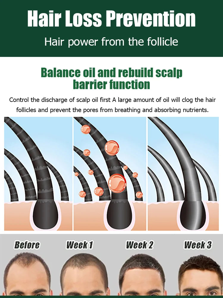 [No.1 Selling Hair Growth Product] Battana Rosemary Essential Oil