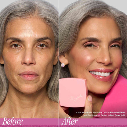 Limited Edition Cancer Schmancer Kit (3PC)