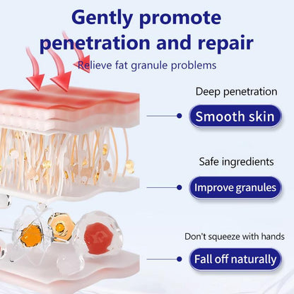 Derm-Free Milia Remover Serum