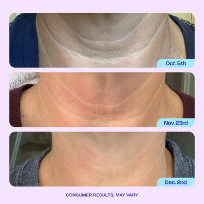 GOPUCE Miracle Neck Cream: Erase "Turkey Neck" & "Tech Neck" Lines Visible Lift & Smoothness in 4 Weeks