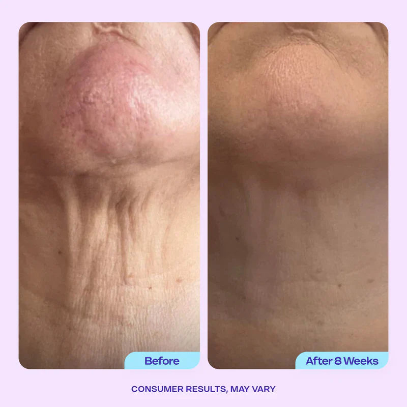 GOPUCE Miracle Neck Cream: Erase "Turkey Neck" & "Tech Neck" Lines Visible Lift & Smoothness in 4 Weeks