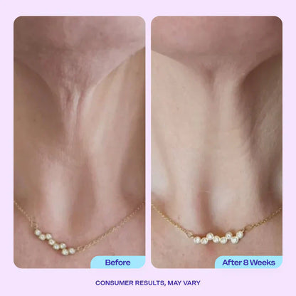 GOPUCE Miracle Neck Cream: Erase "Turkey Neck" & "Tech Neck" Lines Visible Lift & Smoothness in 4 Weeks