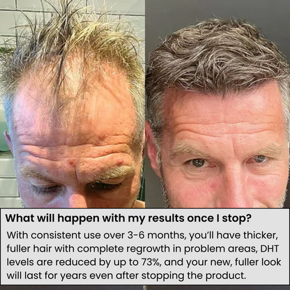 Agelessory™ Hair Regrowth System