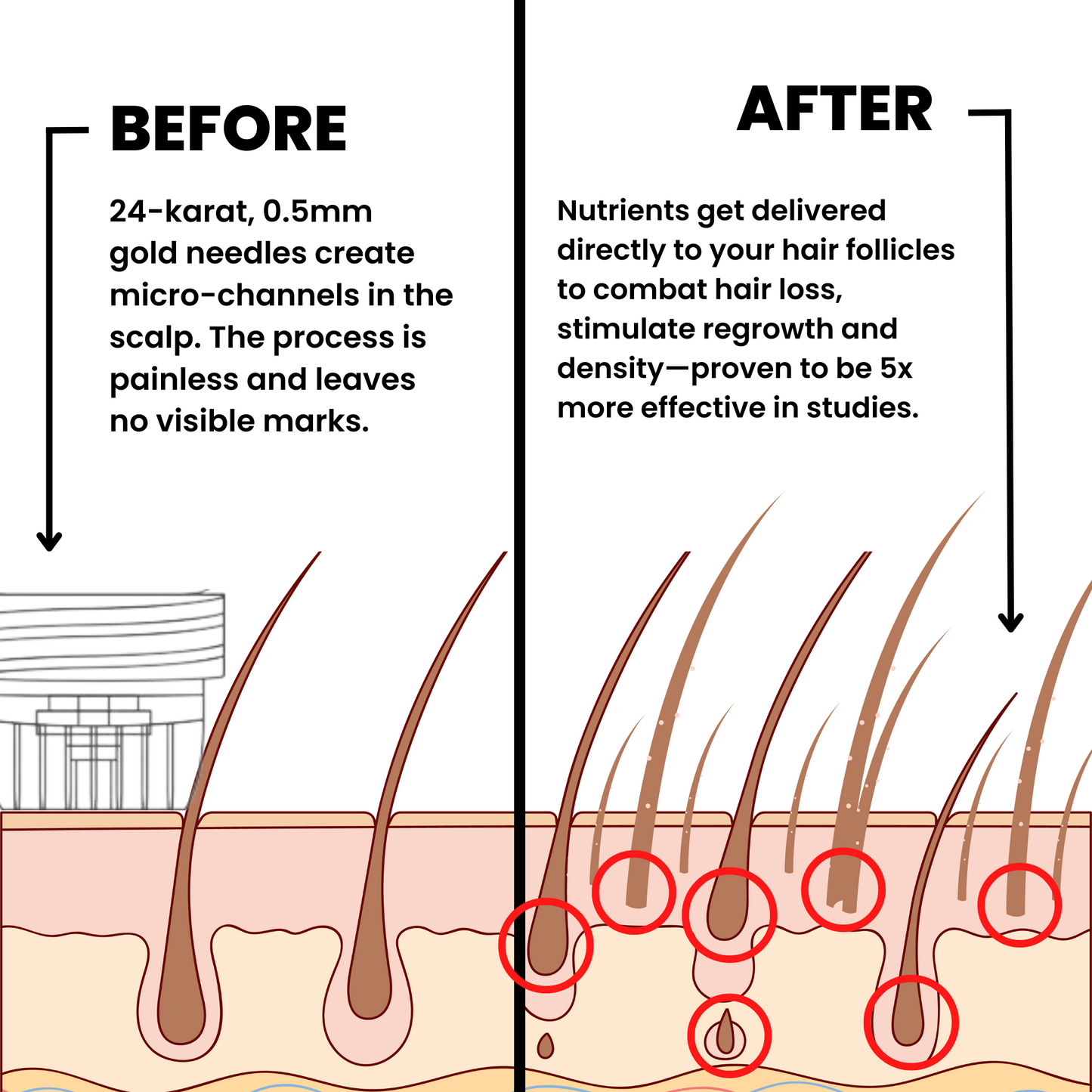 Agelessory™ Hair Regrowth System