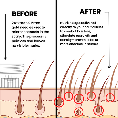 Agelessory™ Hair Regrowth System