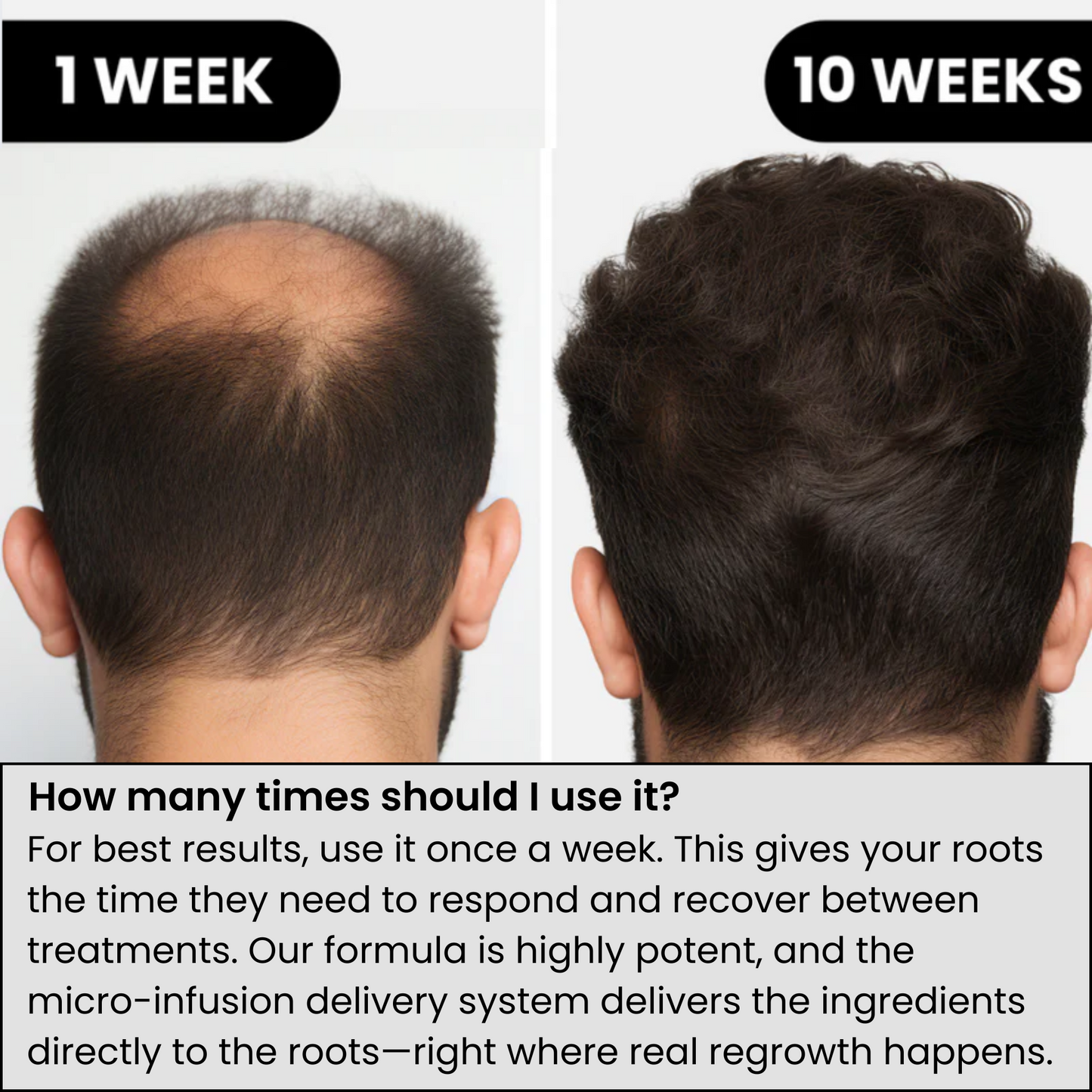 Agelessory™ Hair Regrowth System