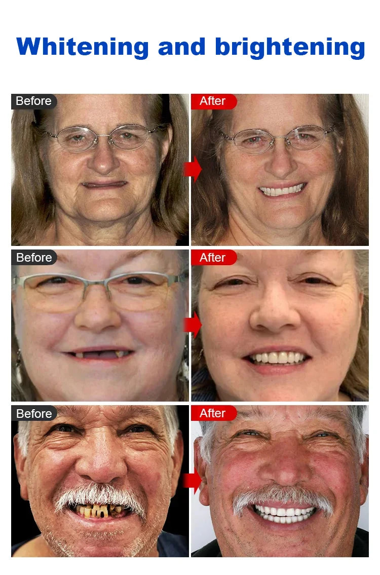 [Instant Repair Toothpaste] 7.5% Nano Hydroxyapatite Toothpaste