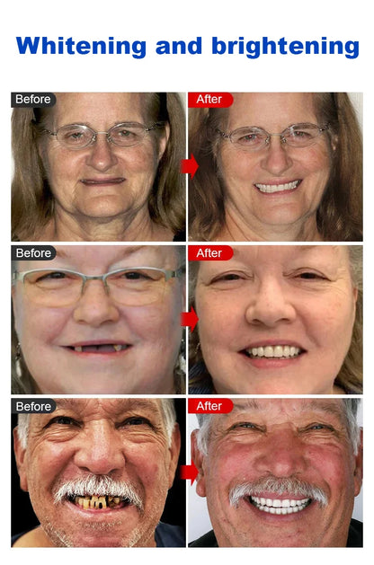 [Instant Repair Toothpaste] 7.5% Nano Hydroxyapatite Toothpaste