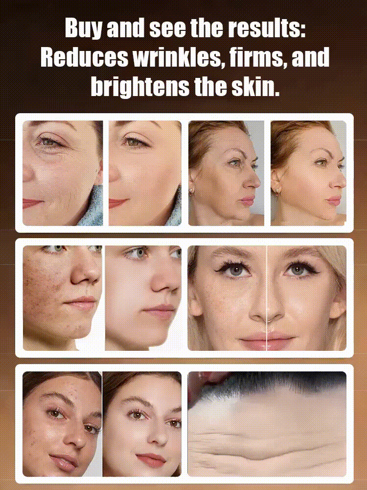 Arbutin and Niacinamide Anti-Wrinkle Cream