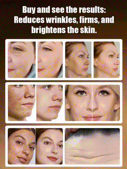 Arbutin and Niacinamide Anti-Wrinkle Cream