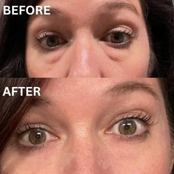 InstantFirm Eye Patches | 1+1 FREE