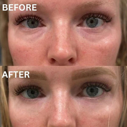 InstantFirm Eye Patches | 1+1 FREE