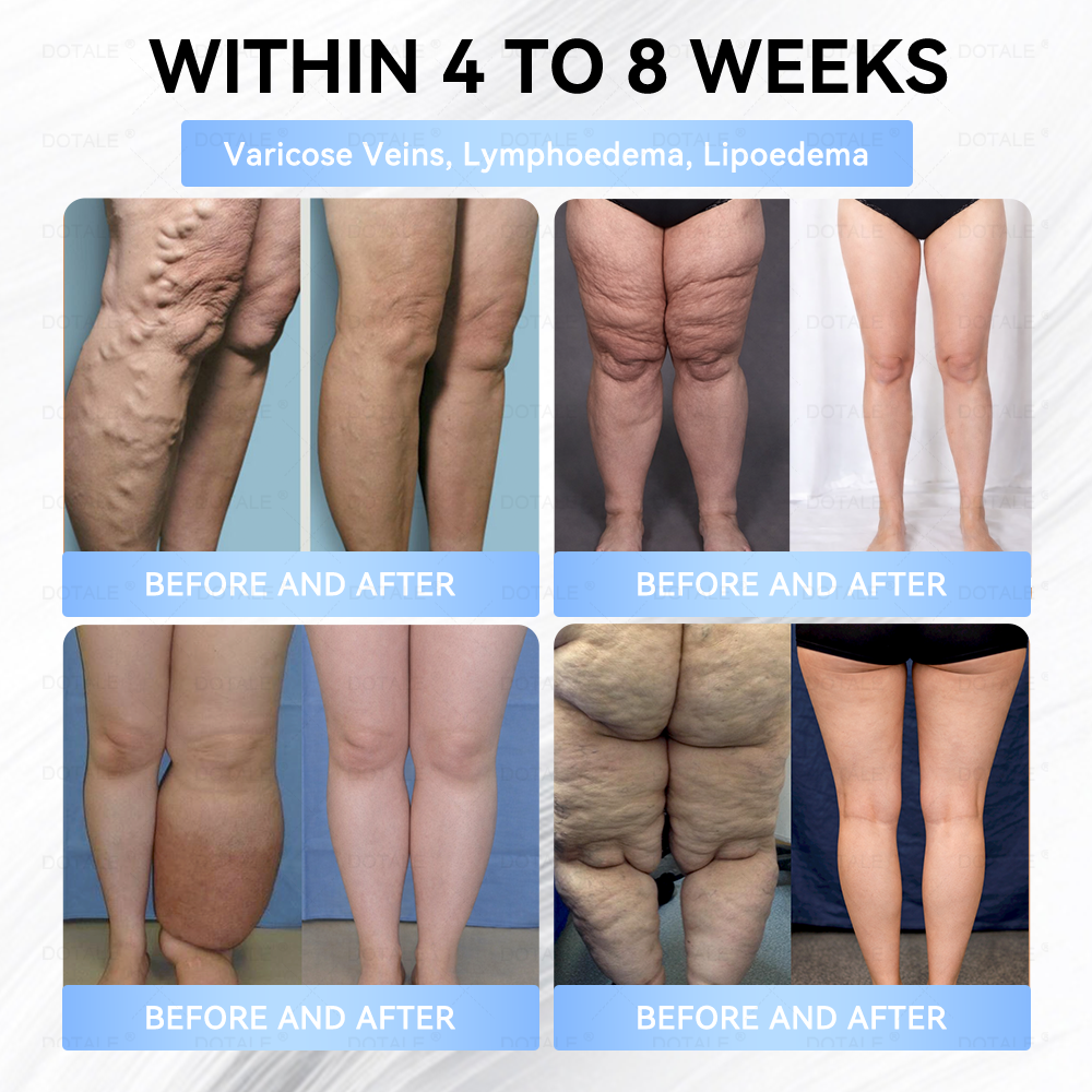 𝑫𝑶𝑻𝑨𝑳𝑬® 𝑴𝒆𝒕𝒂𝒃𝒐𝒍𝒊𝒄 𝑵𝒂𝒏𝒐 𝑴𝒊𝒄𝒓𝒐𝒏𝒆𝒆𝒅𝒍𝒆 𝑷𝒂𝒕𝒄𝒉(𝐉𝐮𝐬𝐭 𝐨𝐧𝐜𝐞 𝐚 𝐝𝐚𝐲, 𝐯𝐢𝐬𝐢𝐛𝐥𝐞 𝐜𝐡𝐚𝐧𝐠𝐞𝐬 𝐢𝐧 𝟕 𝐝𝐚𝐲𝐬）𝘽𝙚𝙧𝙗𝙚𝙧𝙞𝙣𝙚 + 𝙈𝙤𝙧𝙞𝙣𝙜𝙖 𝙁𝙤𝙧𝙢𝙪𝙡𝙖 ✅ 𝐅𝐨𝐫 𝐨𝐛𝐞𝐬𝐢𝐭𝐲, 𝗟𝗼𝗼𝘀𝗲 𝘀𝗸𝗶𝗻,𝐝𝐢𝐚𝐛𝐞𝐭𝐞𝐬, 𝐬𝐥𝐞𝐞𝐩 𝐚𝐩𝐧𝐞𝐚, 𝐣𝐨𝐢𝐧𝐭 𝐢𝐬𝐬𝐮𝐞𝐬, 𝐚𝐧𝐝 𝐦𝐨𝐫𝐞