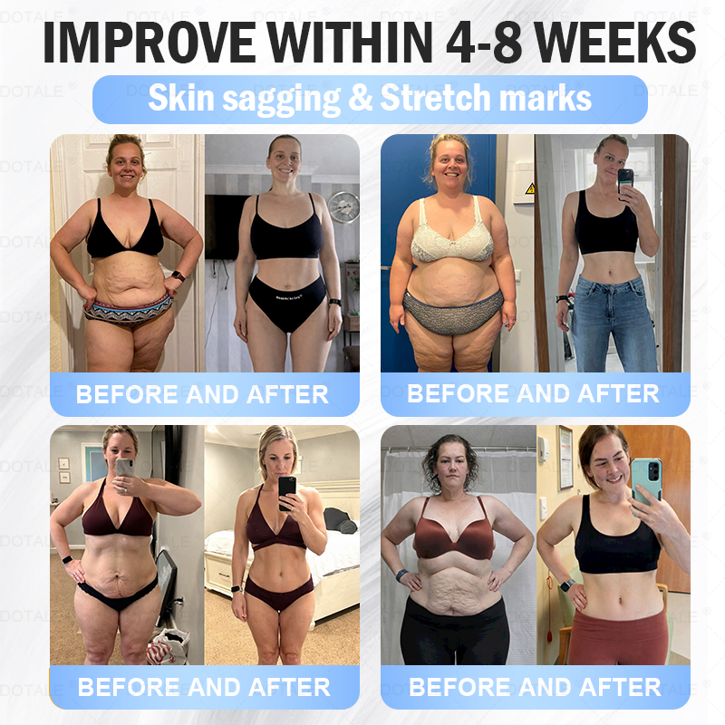 𝑫𝑶𝑻𝑨𝑳𝑬® 𝑴𝒆𝒕𝒂𝒃𝒐𝒍𝒊𝒄 𝑵𝒂𝒏𝒐 𝑴𝒊𝒄𝒓𝒐𝒏𝒆𝒆𝒅𝒍𝒆 𝑷𝒂𝒕𝒄𝒉(𝐉𝐮𝐬𝐭 𝐨𝐧𝐜𝐞 𝐚 𝐝𝐚𝐲, 𝐯𝐢𝐬𝐢𝐛𝐥𝐞 𝐜𝐡𝐚𝐧𝐠𝐞𝐬 𝐢𝐧 𝟕 𝐝𝐚𝐲𝐬）𝘽𝙚𝙧𝙗𝙚𝙧𝙞𝙣𝙚 + 𝙈𝙤𝙧𝙞𝙣𝙜𝙖 𝙁𝙤𝙧𝙢𝙪𝙡𝙖 ✅ 𝐅𝐨𝐫 𝐨𝐛𝐞𝐬𝐢𝐭𝐲, 𝗟𝗼𝗼𝘀𝗲 𝘀𝗸𝗶𝗻,𝐝𝐢𝐚𝐛𝐞𝐭𝐞𝐬, 𝐬𝐥𝐞𝐞𝐩 𝐚𝐩𝐧𝐞𝐚, 𝐣𝐨𝐢𝐧𝐭 𝐢𝐬𝐬𝐮𝐞𝐬, 𝐚𝐧𝐝 𝐦𝐨𝐫𝐞