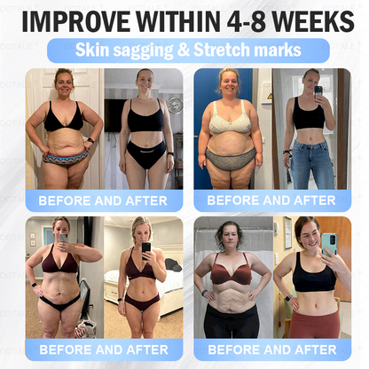 𝑫𝑶𝑻𝑨𝑳𝑬® 𝑴𝒆𝒕𝒂𝒃𝒐𝒍𝒊𝒄 𝑵𝒂𝒏𝒐 𝑴𝒊𝒄𝒓𝒐𝒏𝒆𝒆𝒅𝒍𝒆 𝑷𝒂𝒕𝒄𝒉(𝐉𝐮𝐬𝐭 𝐨𝐧𝐜𝐞 𝐚 𝐝𝐚𝐲, 𝐯𝐢𝐬𝐢𝐛𝐥𝐞 𝐜𝐡𝐚𝐧𝐠𝐞𝐬 𝐢𝐧 𝟕 𝐝𝐚𝐲𝐬）𝘽𝙚𝙧𝙗𝙚𝙧𝙞𝙣𝙚 + 𝙈𝙤𝙧𝙞𝙣𝙜𝙖 𝙁𝙤𝙧𝙢𝙪𝙡𝙖 ✅ 𝐅𝐨𝐫 𝐨𝐛𝐞𝐬𝐢𝐭𝐲, 𝗟𝗼𝗼𝘀𝗲 𝘀𝗸𝗶𝗻,𝐝𝐢𝐚𝐛𝐞𝐭𝐞𝐬, 𝐬𝐥𝐞𝐞𝐩 𝐚𝐩𝐧𝐞𝐚, 𝐣𝐨𝐢𝐧𝐭 𝐢𝐬𝐬𝐮𝐞𝐬, 𝐚𝐧𝐝 𝐦𝐨𝐫𝐞